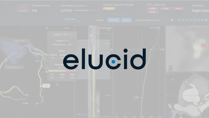 Elucid Raises $55 Million in Oversubscribed Series D Round